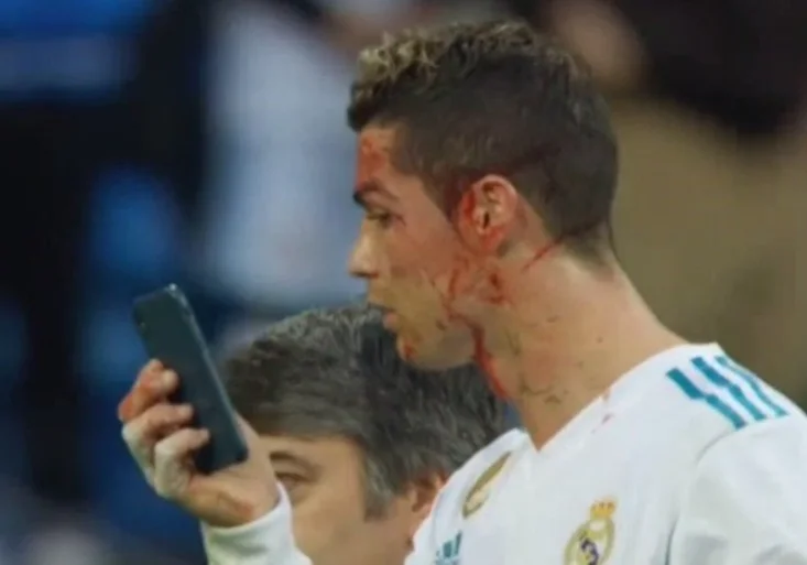 Vylekaný Ronaldo! Utrpěl krvavé zranění, kontroloval se na mobilu