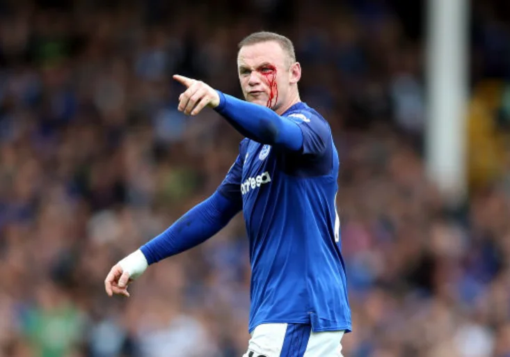 Zkrvavený Rooney vypadal jak z hororu! Proč musel měnit trenýrky?