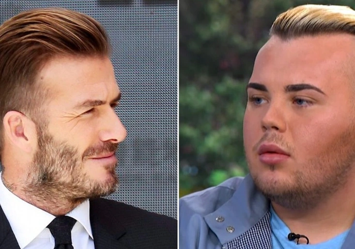 Bláznivý fanda se snaží vypadat jako David Beckham! Na kolik ho vyšly plastiky?